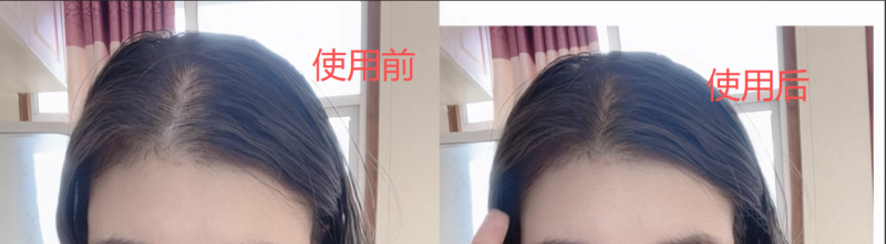 海瑟薇防脱洗发水口碑深度测评：当发质改善成为防脱的有力说明